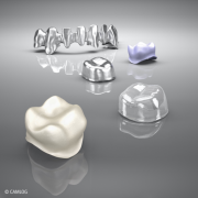 一文解答半口种植牙疑惑，帮你锁定理想种植牙品牌