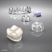 选对品牌，半口种植牙长期效果表现更佳